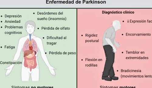 nanomedicina-para-el-tratamiento-de-la-enfermedad-de-parkinson