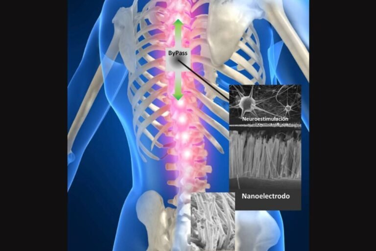 nanomedicina-para-el-tratamiento-de-lesiones-de-la-medula-espinal