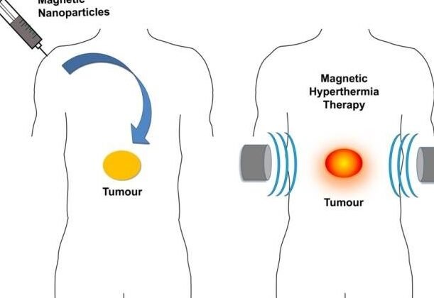 nanoparticulas-magneticas-para-el-tratamiento-de-la-hipertermia-oncologica