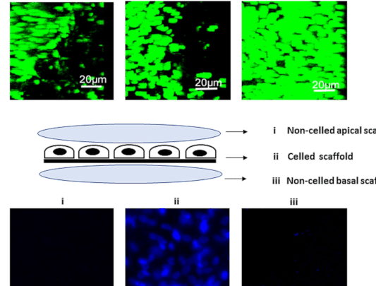 nanotecnologia-para-el-tratamiento-de-la-degeneracion-macular-asociada-a-la-edad