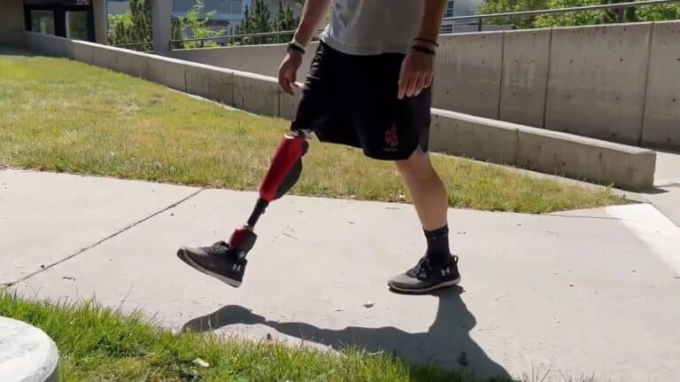 protesis-de-pierna-bionicas-con-tobillo-motorizado