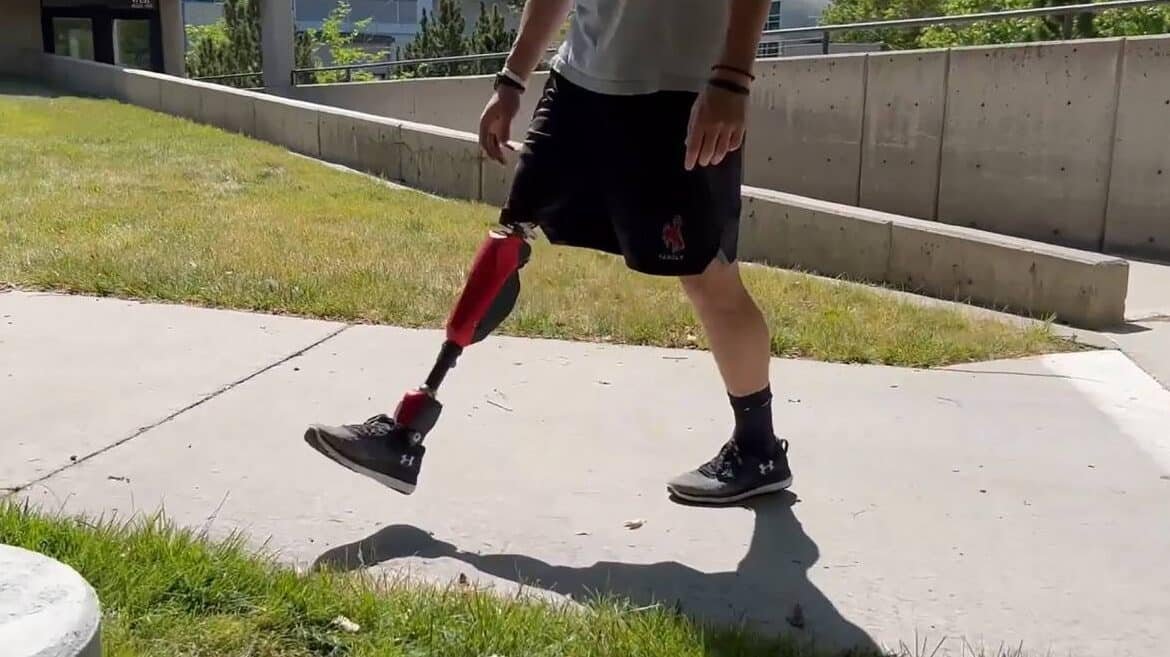 protesis-de-pierna-bionicas-con-tobillo-motorizado