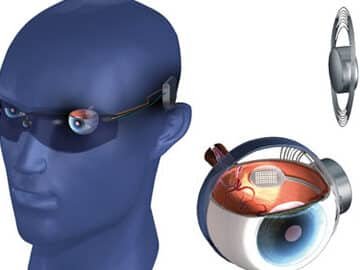 protesis-de-retina-avances-hacia-la-vision-artificial