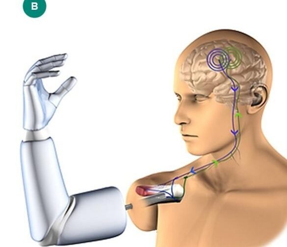 protesis-roboticas-controladas-por-senales-nerviosas