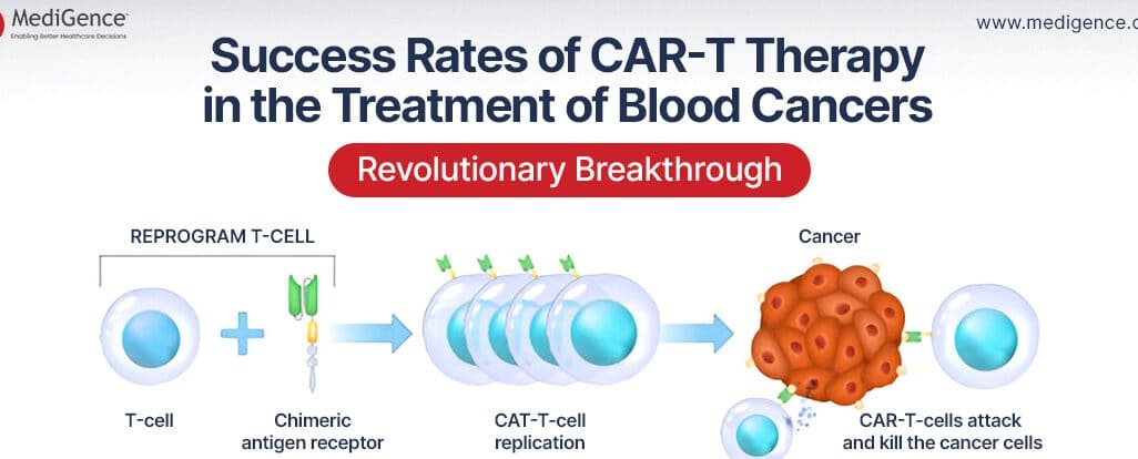 terapia-car-t-contra-el-linfoma-no-hodgkin-tasas-de-exito