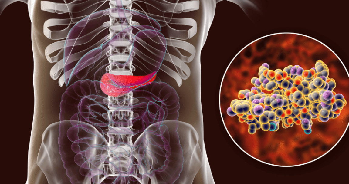 terapia-celular-para-la-diabetes-tipo-1-reemplazo-de-islotes