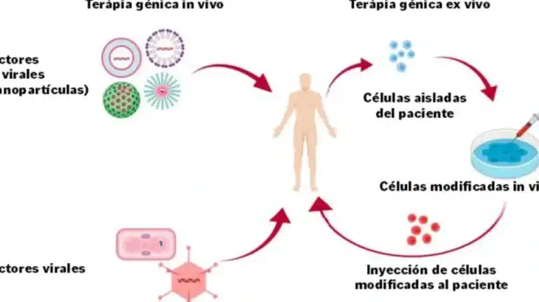 terapia-genica-ex-vivo-para-la-inmunodeficiencia-combinada-severa