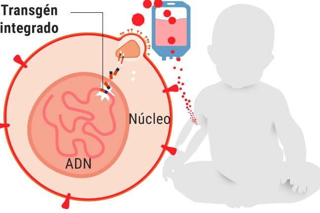 terapia-genica-para-la-inmunodeficiencia-combinada-severa-ninos-burbuja