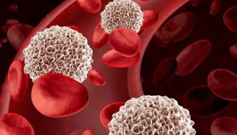 terapia-genica-para-la-talasemia-beta-vivir-sin-transfusiones