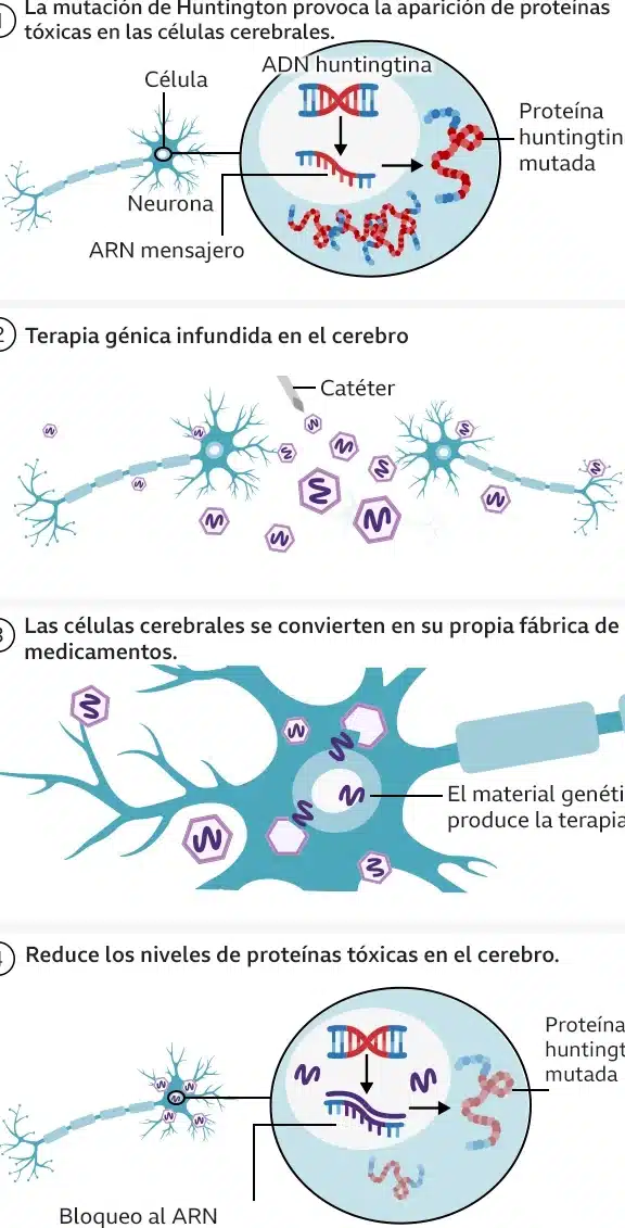 terapias-avanzadas-para-la-enfermedad-de-huntington