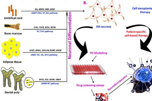 terapias-avanzadas-para-la-enfermedad-de-parkinson-ensayos-actuales