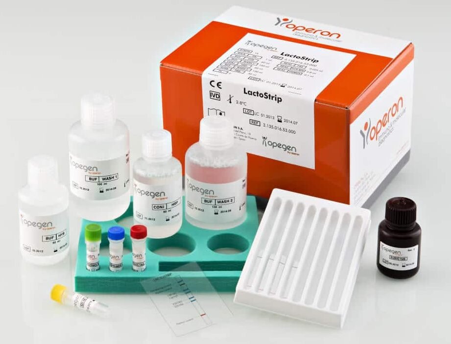 test-farmacogenomicos-para-medicamentos-contra-el-vih-abacavir