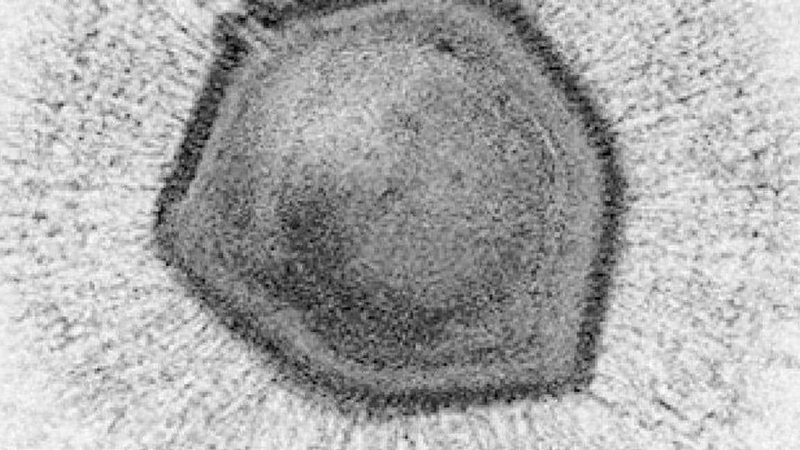 como-los-virus-gigantes-mimivirus-cambian-nuestra-comprension-de-la-biologia