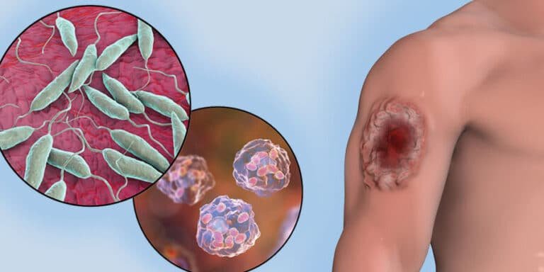nanomedicina-en-la-lucha-contra-la-leishmaniasis-y-enfermedades-tropicales