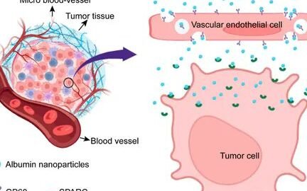 nanoparticulas-de-albumina-el-exito-detras-del-abraxane